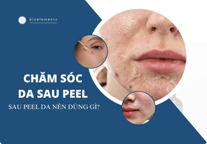 Chăm sóc da sau peel